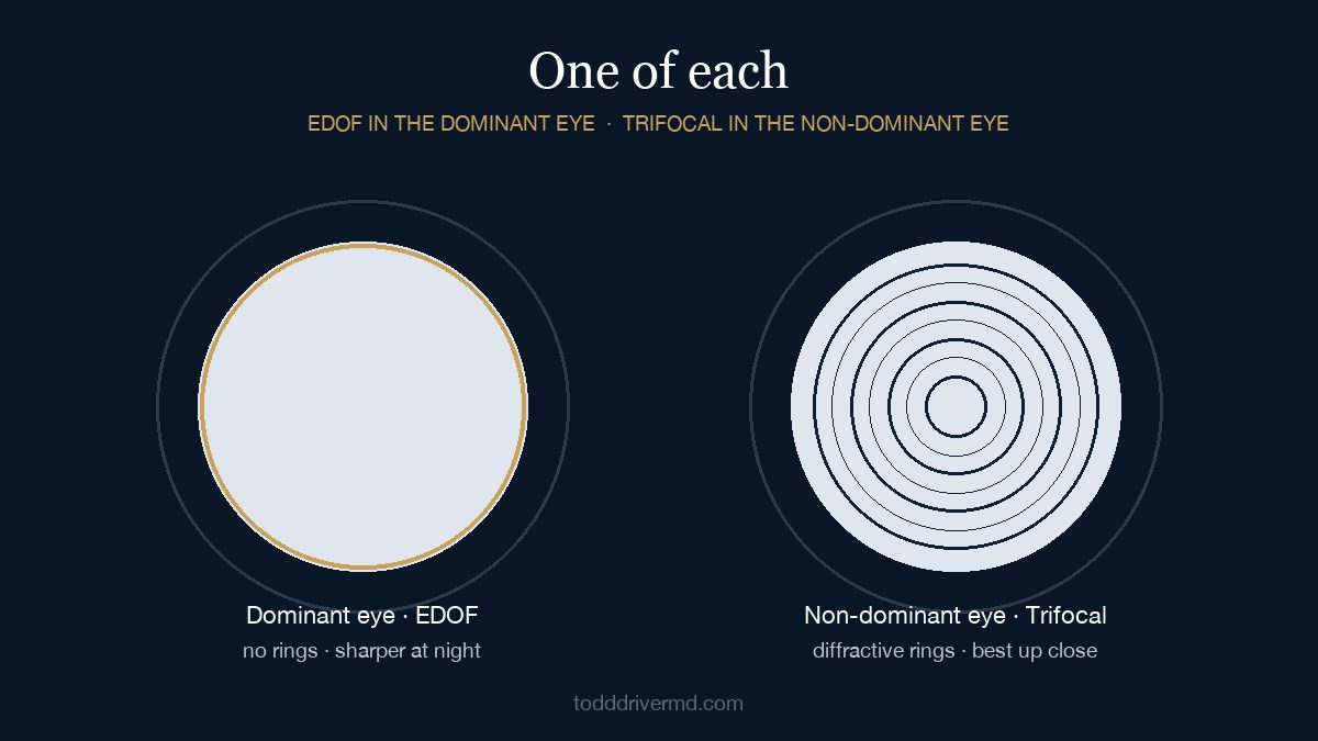 Diagram of two eyes: the dominant eye with a smooth extended depth of focus lens and no rings, the non-dominant eye with a trifocal lens showing concentric diffractive rings.